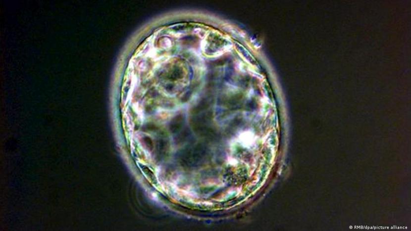 Ilmuwan Berhasil Ciptakan Model Embrio  Manusia