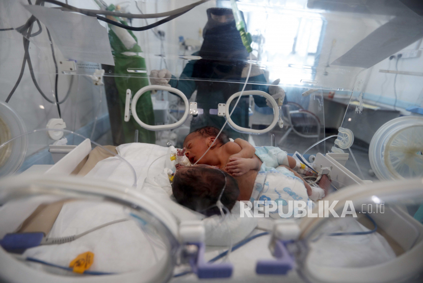  Bayi kembar siam laki-laki berbaring di dalam inkubator di unit perawatan intensif neonatal rumah sakit.