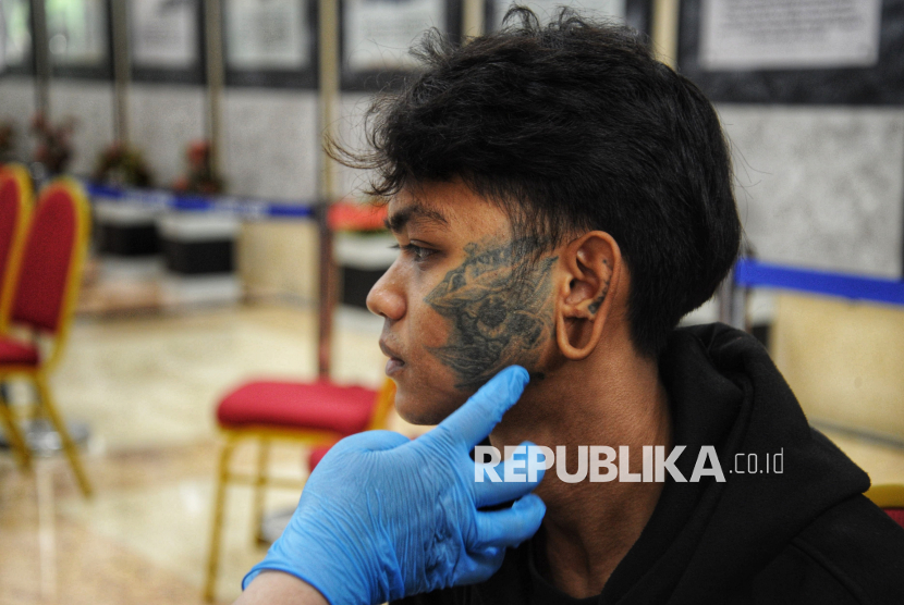 ILUSTRASI Layanan medis untuk hapus tato
