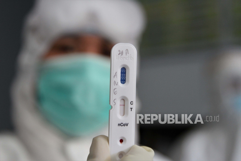 Petugas medis menunjukan rapid test atau pemeriksaan cepat COVID-19 yang diambil dari salah satu sampel darah di Kendari, Sulawesi Tenggara. Seorang bayi berstatus pasien dalam pengawasan (PDP) COVID-19 meninggal dunia di Rumah Sakit Umum Daerah (RSUD) Bahteramas Kendari, Provinsi Sulawesi Tenggara (Sultra).