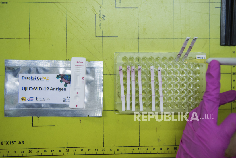 Peneliti melakukan formulasi Rapid Test CePAD Antigen di Pusat Riset Bioteknologi Molekular dan Bioinformatika Universitas Padjadjaran, Bandung, Jawa Barat, Kamis (21/5/2020). Universitas Padjadjaran bekerja sama dengan Tekad Mandiri Citra dan Pakar Biomedika Indonesia menciptakan dan memproduksi Rapid Test CePAD Antigen guna mendeteksi keberadaan virus dalam penanganan COVID-19 atau penyakit infeksi lainnya