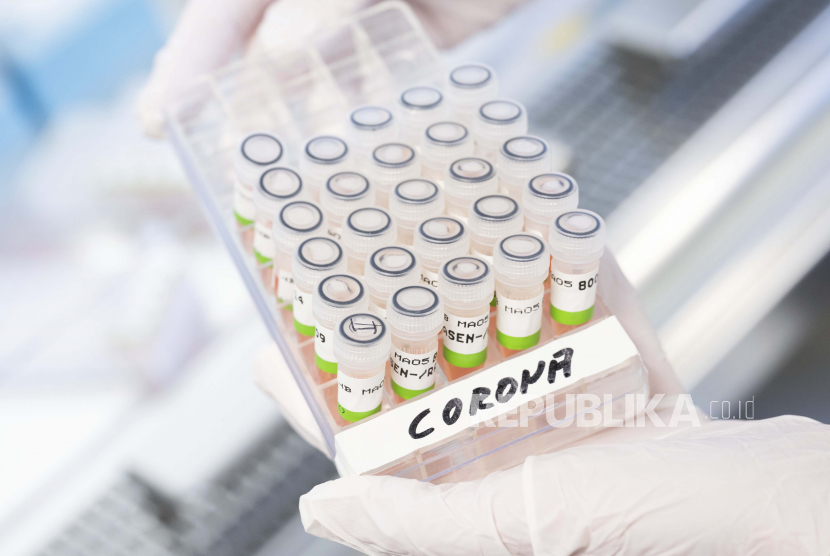 Tes PCR Covid-19 (Ilustrasi). RT-LAMP dapat mengeluarkan hasil tes Covid-19 dalam waktu kurang dari satu jam. Hasil tesnya seakurat RT-PCR.