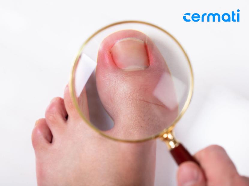 Cermati