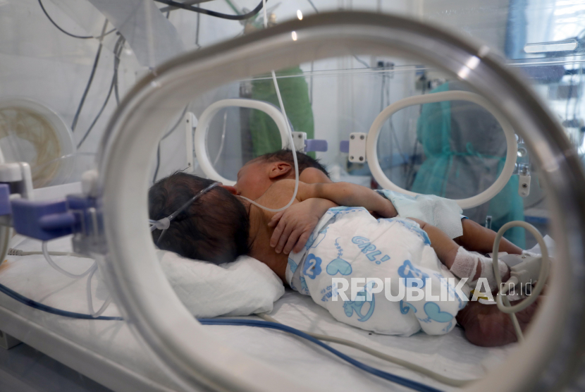  Bayi kembar siam laki-laki berbaring di dalam inkubator di unit perawatan intensif neonatal rumah sakit Al-Sabaeen, di Sana