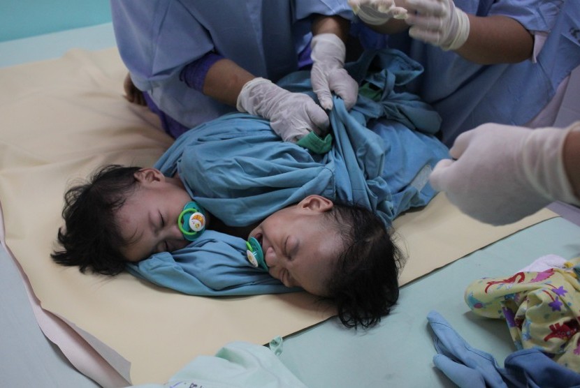 Tim medis menyelimuti Aqila dan Azila kembar siam asal Kendari, Sulawesi Tenggara di Instalansi Rawat Inap (Irna) anak RSUD Dr Soetomo Surabaya, Jawa Timur, Rabu (14/8/2019).