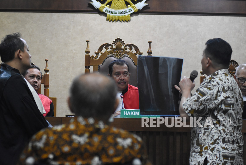 Dokter dari terdakwa kasus dugaan kepemilikan senjata api ilegal Kivlan Zen menunjukkan hasil rontgen kliennyya saat menjalani sidang pembacaan eksepsi di Pengadilan Negeri Jakarta Pusat, Kamis (3/10/2019). 