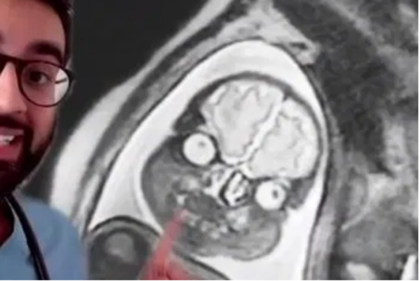  Dokter yang juga penggiat media sosial menunjukkan foto janin yang tampak menyeramkan dari hasil MRI.
