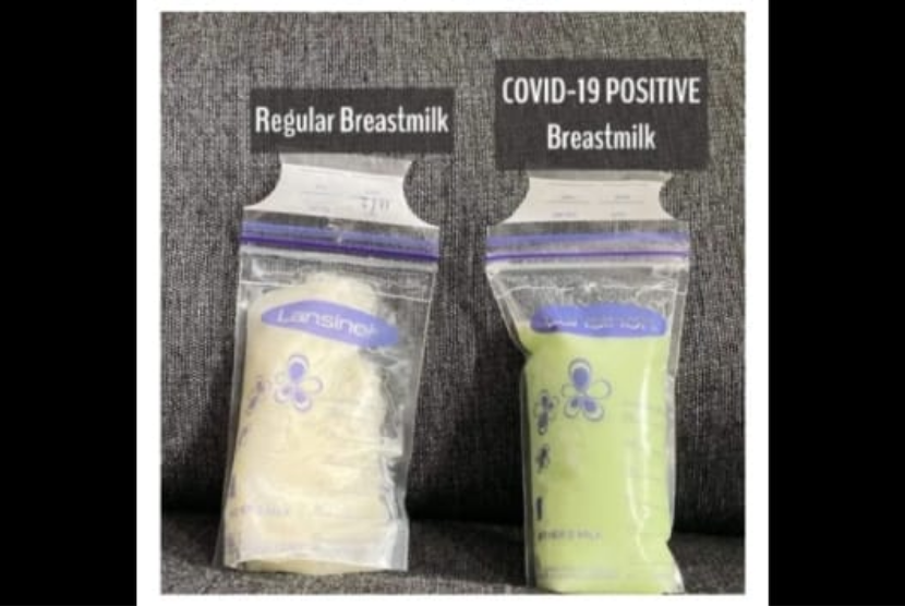 Akun Instagram @ashmiry_ membagikan foto yang memperlihatkan perbedaan warna ASI saat sebelum dan setelah bayi dari seorang ibu di Australia positif Covid-19. Warna hijau diklaim sebagai bentuk adanya perubahan nutrisi untuk bayi positif Covid-19.