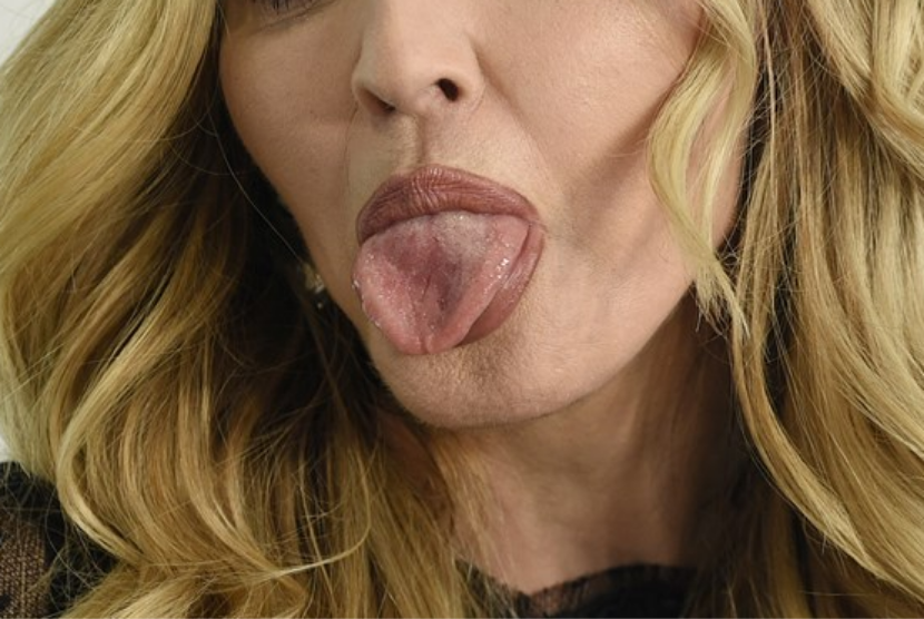 Seorang perempuan menjulurkan lidahnya. Perubahan pada lidah bisa menjadi indikasi beberapa penyakit mematikan.