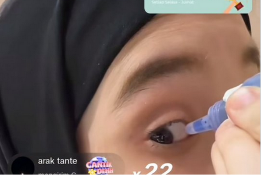 Figur publik Inara Rusli memakai obat tetes mata saat live TikTok.
