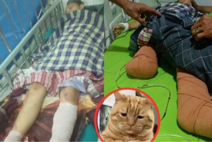 Nabila Febrianti, anak SD asal Sumatra Utara, kakinya diamputasi setelah terlindas truk saat selamatkan anak kucing.