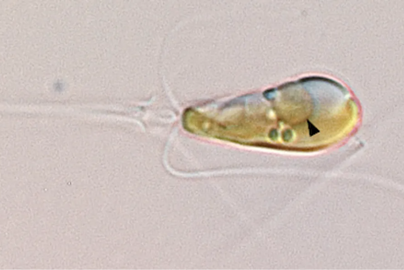 Gambar mikroskop cahaya menunjukkan ganggang laut Braarudosphaera bigelowii, yang berpotensi merupakan langkah evolusi besar. Ganggang ini menyerap bakteri yang disebut UCYN-A dan membentuk organel baru yang disebut nitroplast. Panah hitam menunjuk ke nitroplast. 