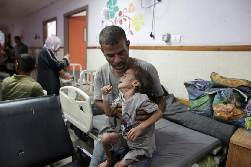Anak Gaza yang mengalami malnutrisi di rawat di Rumah Sakit Martir Al-Aqsa di Deir al-Balah di Jalur Gaza tengah, Sabtu, 1 Juni 2024.