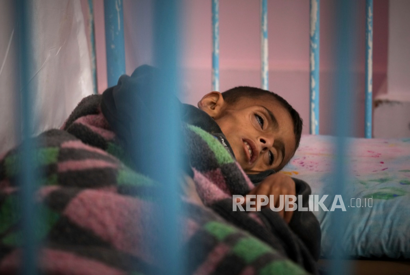 Osama al-Raqab (5 tahun), dirawat akibat mengalami malnutrisi akut di rumah sakit Nasser, Khan Younis, Gaza, pada Kamis, 1 Mei 2025. 