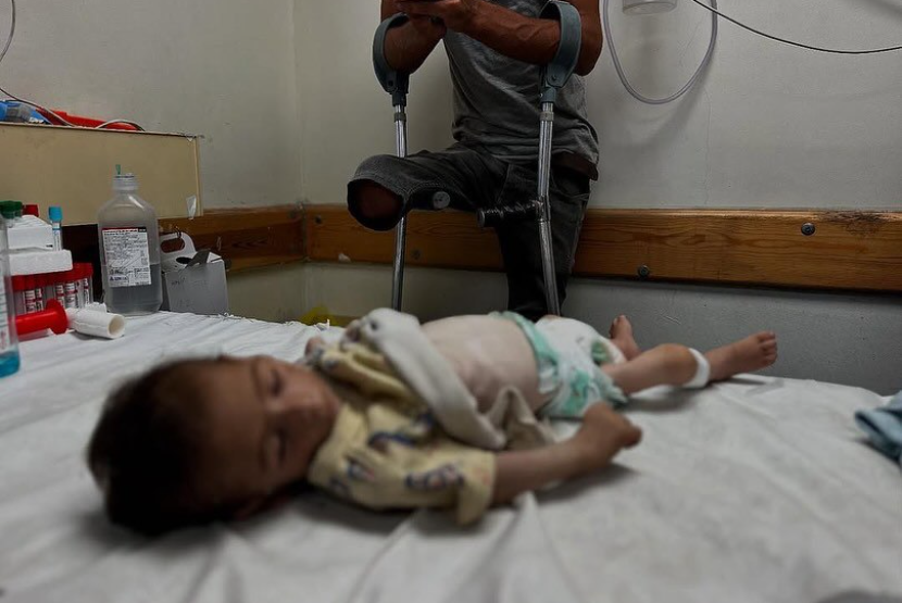 Bayi berusia tiga bulan, Fadi al-Najjar dari Khan Younis, meninggal dunia akibat kelaparan buatan Israel di Jalur Gaza, Sabtu (19/7/2025).