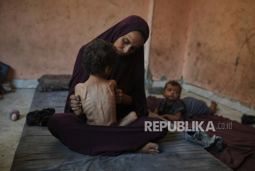 Naima Abu Ful berfoto bersama anaknya yang berusia 2 tahun yang kekurangan gizi, Yazan, di rumah mereka di kamp pengungsi Shati di Kota Gaza pada Rabu, 23 Juli 2025.