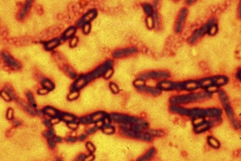 kuman Bacillus anthracis. (ilustrasi)