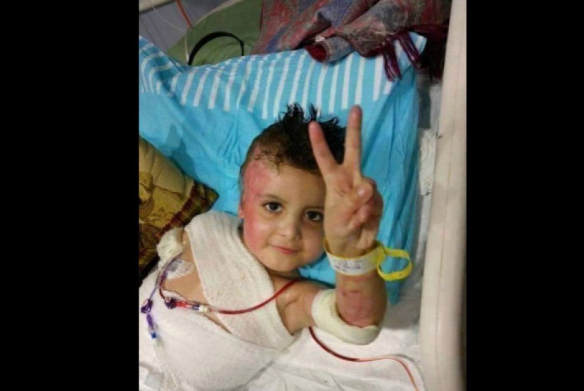 Ahmad Dawabsha (4 tahun) korban pembakaran rumah oleh warga Israel. 