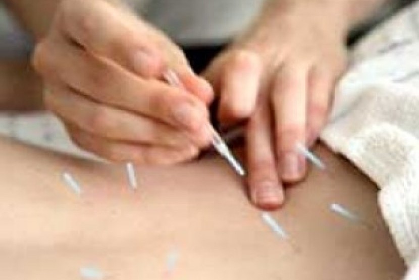 Akupuntur (ilustrasi). Dokter mengatakan akupuntur bisa menjadi terapi pasien penyakit ginjal kronik anak.