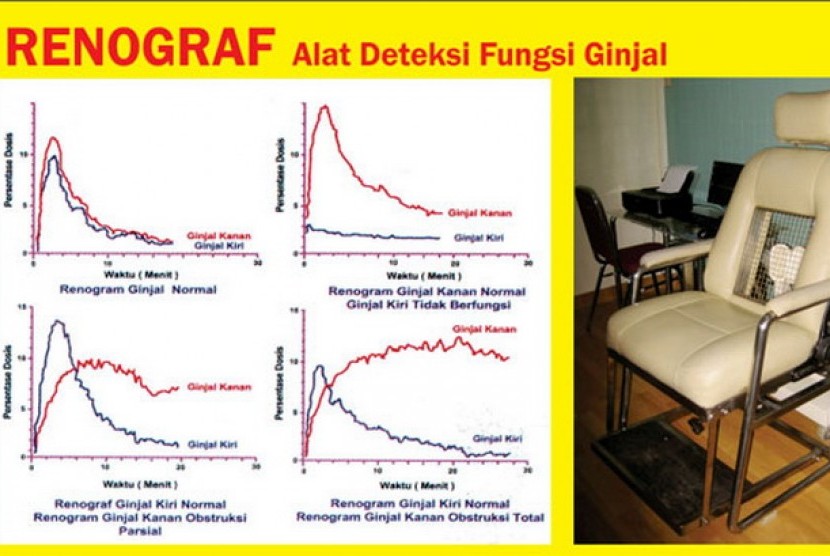 Alat renogram dan hasil deteksi ginjalnya, renograf.