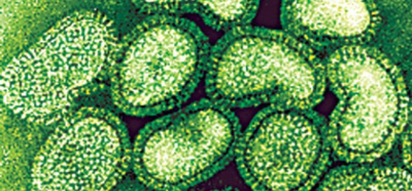 An electron microscope image shows H1N1 virus. 