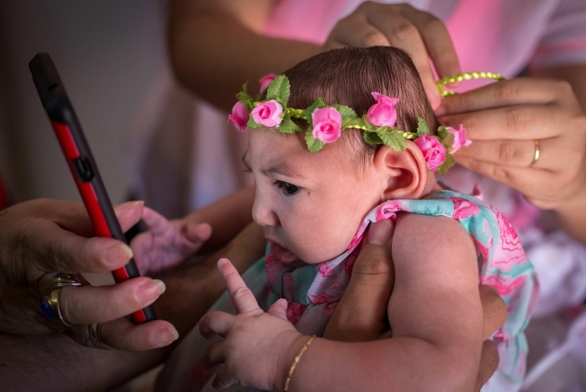 Ana Beatriz, bayi berusia empat bulan, yang terlahir dengan mikrosefalia diduga akibat virus zika di Brasil.