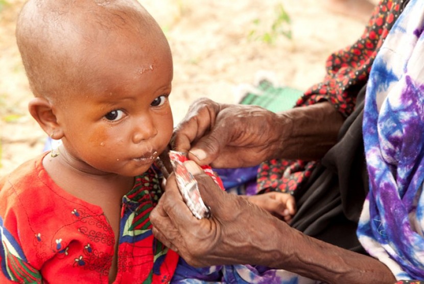 Anak malnutrisi (ilustrasi).