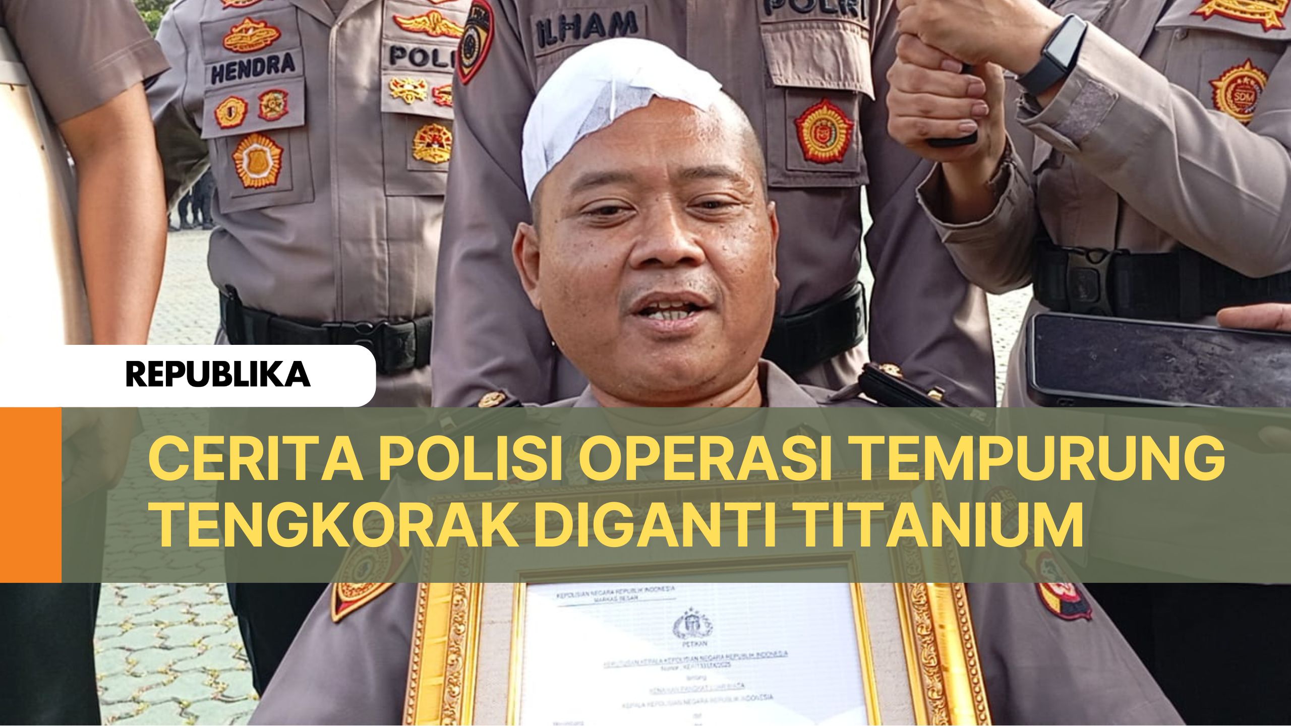 Cerita Ipda Sandi Operasi Tempurung Tengkorak Diganti Titanium