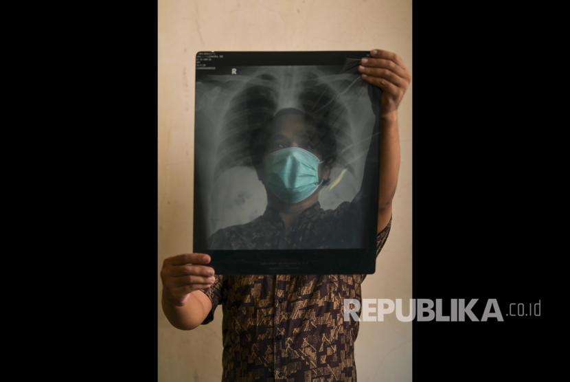 Seorang pria memperlihatkan hasil rontgen paru miliknya. Individu yang memiliki riwayat kanker paru dalam keluarganya juga masuk dalam kategori kelompok berisiko tinggi.