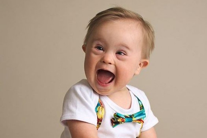 Asher Nash (16 bulan), bayi down syndrome yang akhirnya menjadi model produk Oshkosh