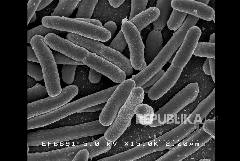 Bakteri E Coli (ilustrasi)