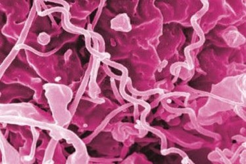 Bakteri sifilis (ilustrasi). Dinkes Riau menemukan 122 kasus sifilis.