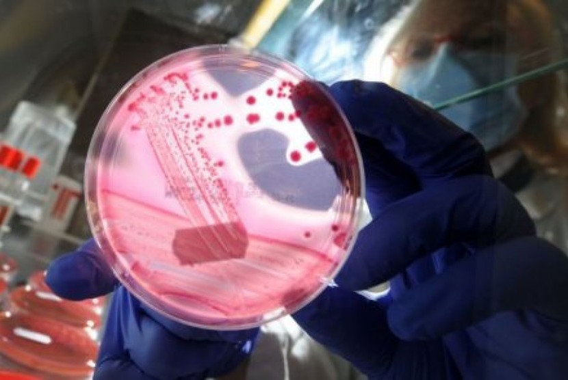 Bakteri yang tahan terhadap antibiotik umum yang merupakan harapan terakhir pengobatan infeksi telah ditemukan di AS.