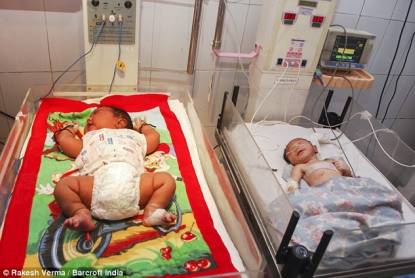 Bayi yang belum diberi nama (kiri) merupakan bayi baru lahir terberat di India dengan berat badan 5,9 kg saat dilahirkan, Rabu pekan lalu.