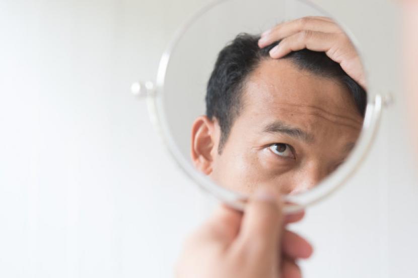 Tips Merawat Rambut Pria Usia Di Atas 40 Tahun Republika Online 