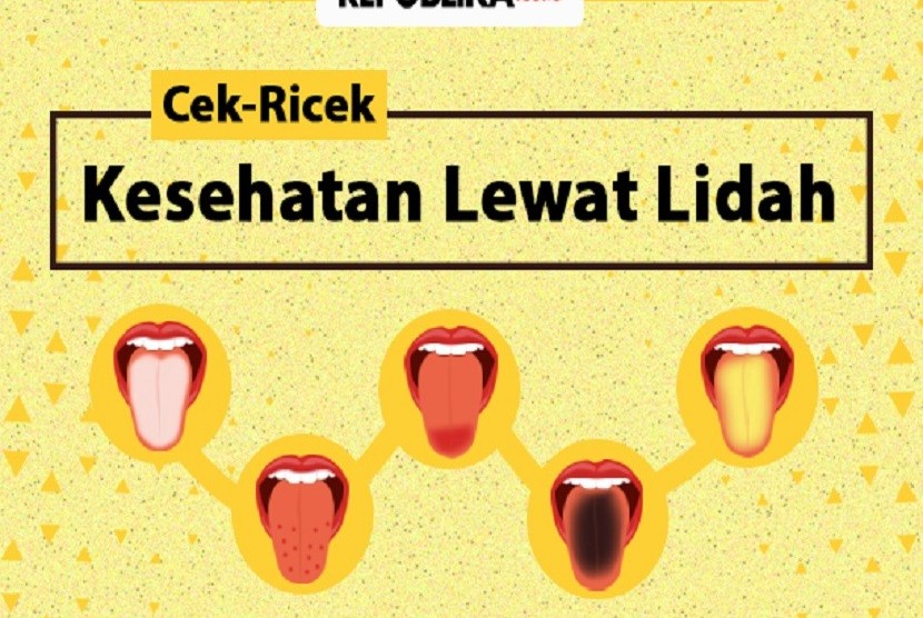 Cek Ricek Kesehatan Lewat Lidah Republika Online