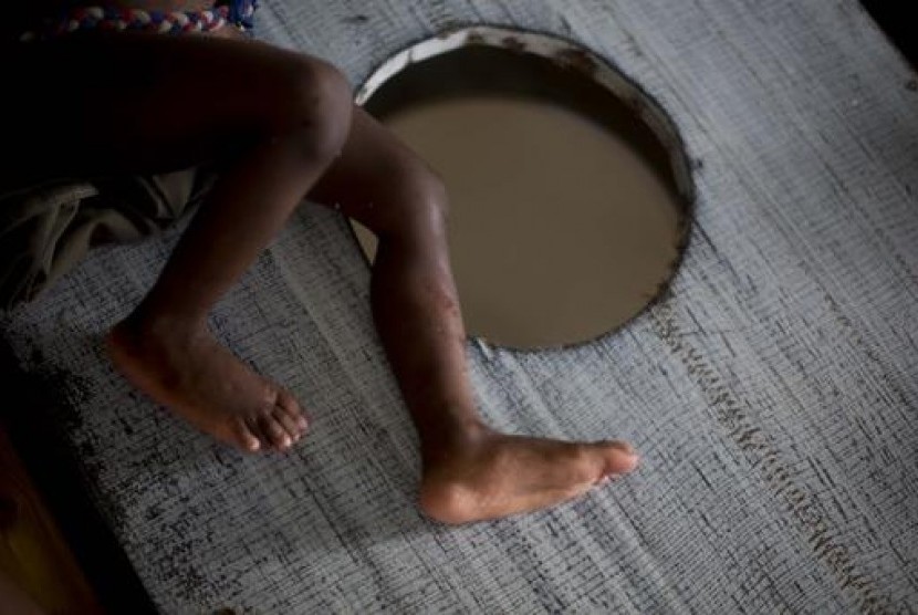Anak yang dirawat karena penyakit kolera (ilustrasi)