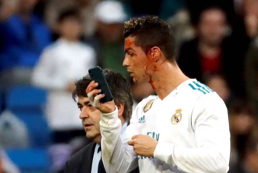 Cristiano Ronaldo menggunakan telepon selular untuk mengecek luka di wajahnya. 