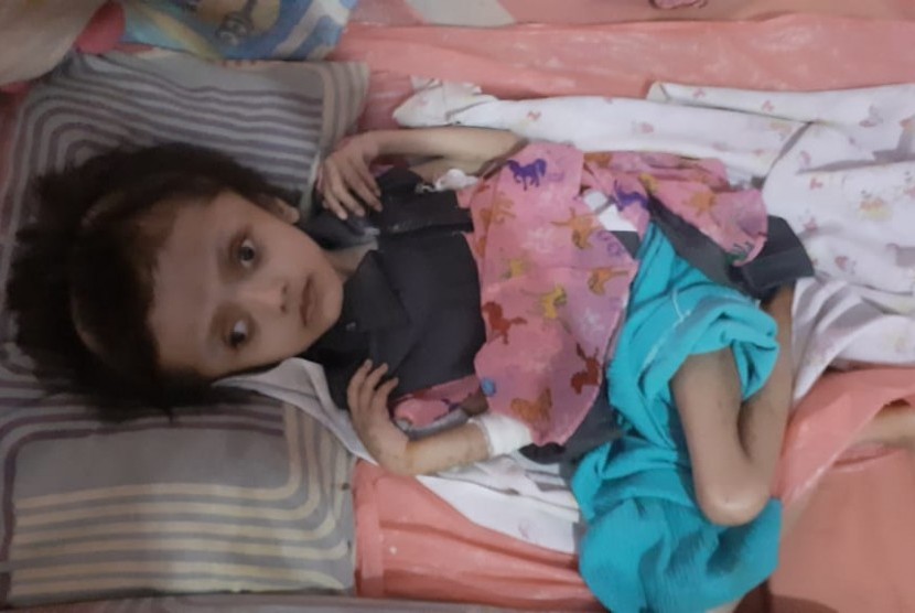 Davina Savania, anak usia 9 tahun penderita Hedrosefalus yang tinggal di Kelurahan Krukut, Kecamatan Limo, Kota Depok mendapatkan pendampingan proses perawatan dari Dinas Kesehatan (Dinkes) Kota Depok. 