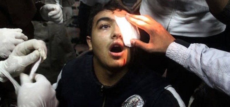 Demonstran yang terluka matanya