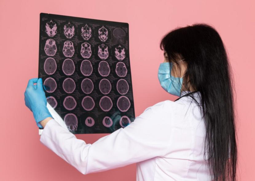 Dokter melihat hasil CT scan kepala pasien (ilustrasi). Seorang wanita berusia 26 tahun kehilangan setengah tengkorak kepalanya akibat infeksi sinus. 