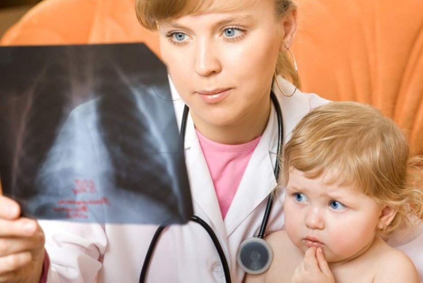 Dokter memeriksa rontgent paru anak yang dicurigai pneumonia.