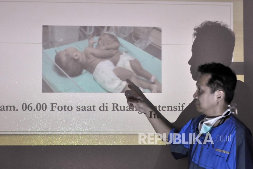 Paediatric surgeon Diki Drajat explained the process to separate conjoined-twins in a press conference at Hasan Sadikin Hospital, Bandung City, Tuesday (October 27).  