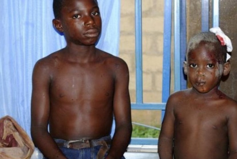 Dua orang anak terluka akibat serangan bom bunuh diri di Nigeria.