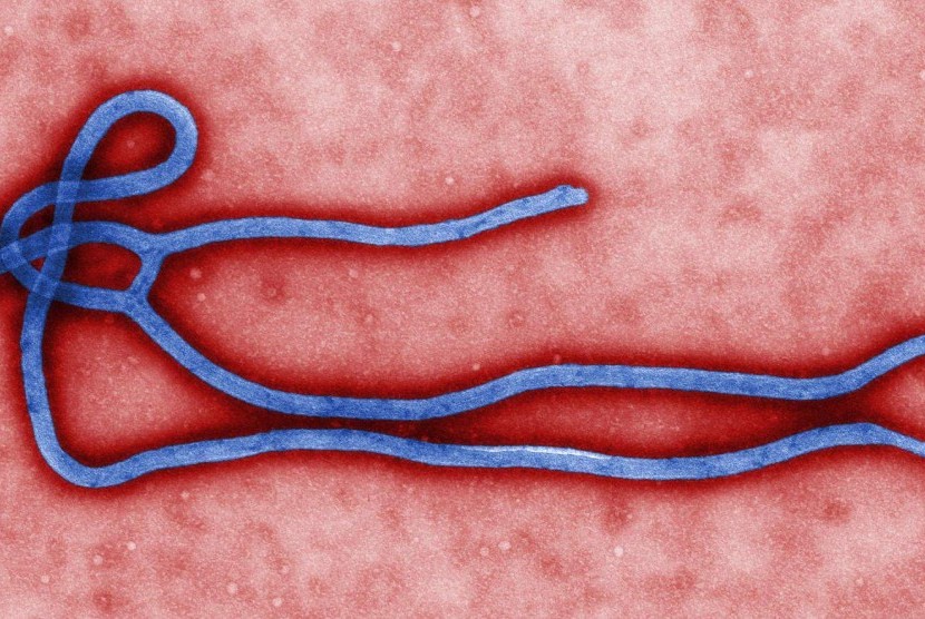 Electron micrograph of an Ebola virus virion (illustration)