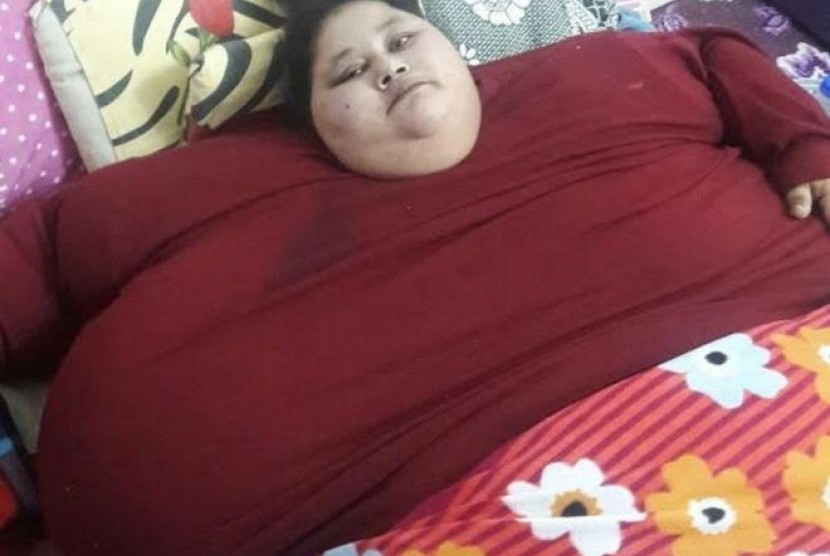 Eman Ahmed Abd El Aty, perempuan Mesir dengan berat ditaksir 500 kg