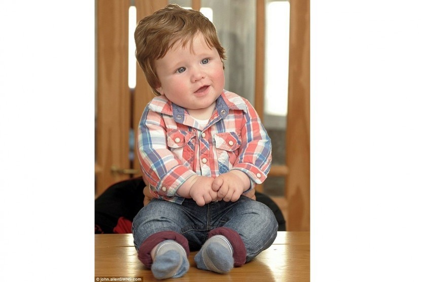 Fergus Hillman, bayi 6 bulan yang memiliki rambut laiknya orang dewasa