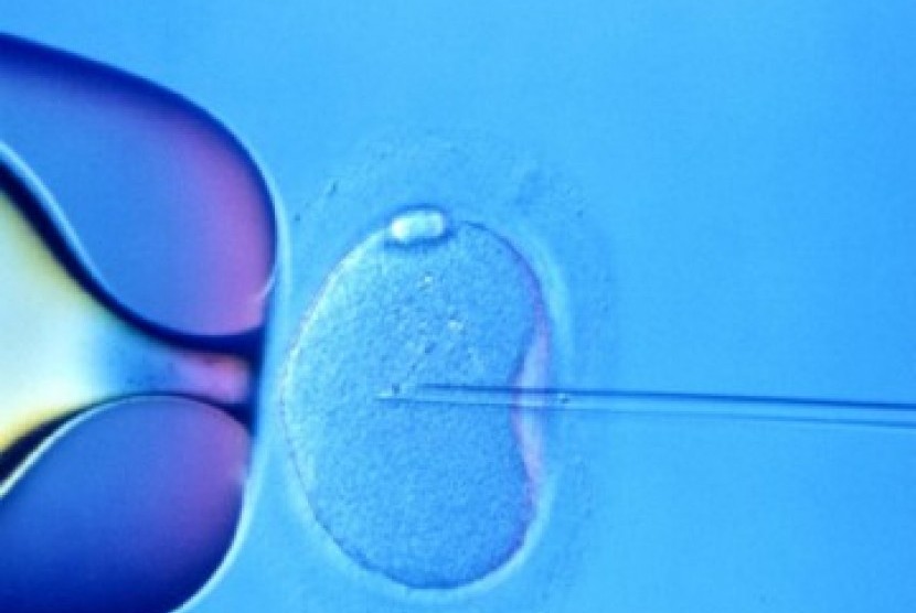 In vitro fertilization. 