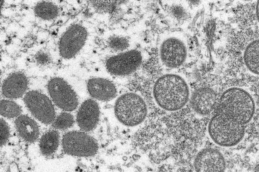  Foto dari mikroskop elektron yang dipasok Pengendalian dan Pencegahan Penyakit pada 2003 memperlihatkan virus monkeypox penyebab cacar monyet. 
