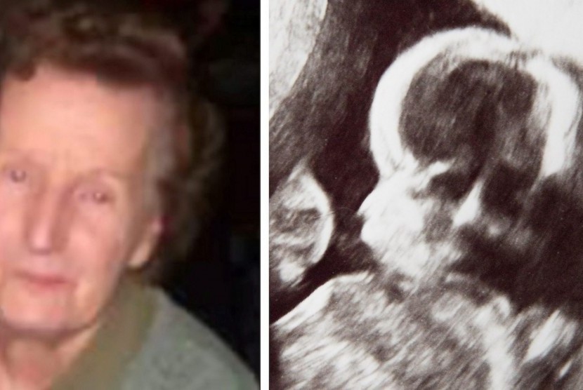 Foto Teresa King disandingkan dengan hasil USG bayi